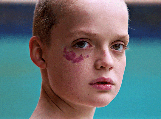 Bring Her Back 2025, dir. Danny Philippou and Michael Philippou angiome plan tache de vin la marque sur le visage